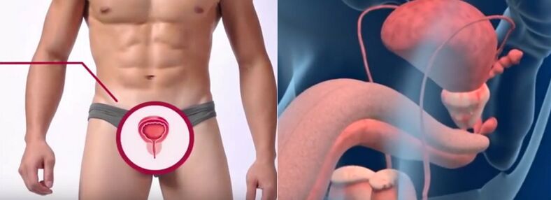 Prostatitis in men is recognized by certain symptoms