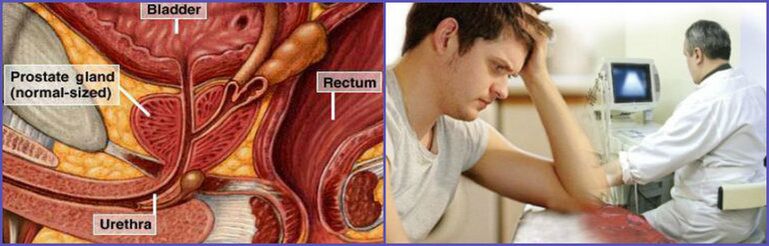 Ultrasound examination of the prostate gland is performed to diagnose chronic prostatitis in men. 